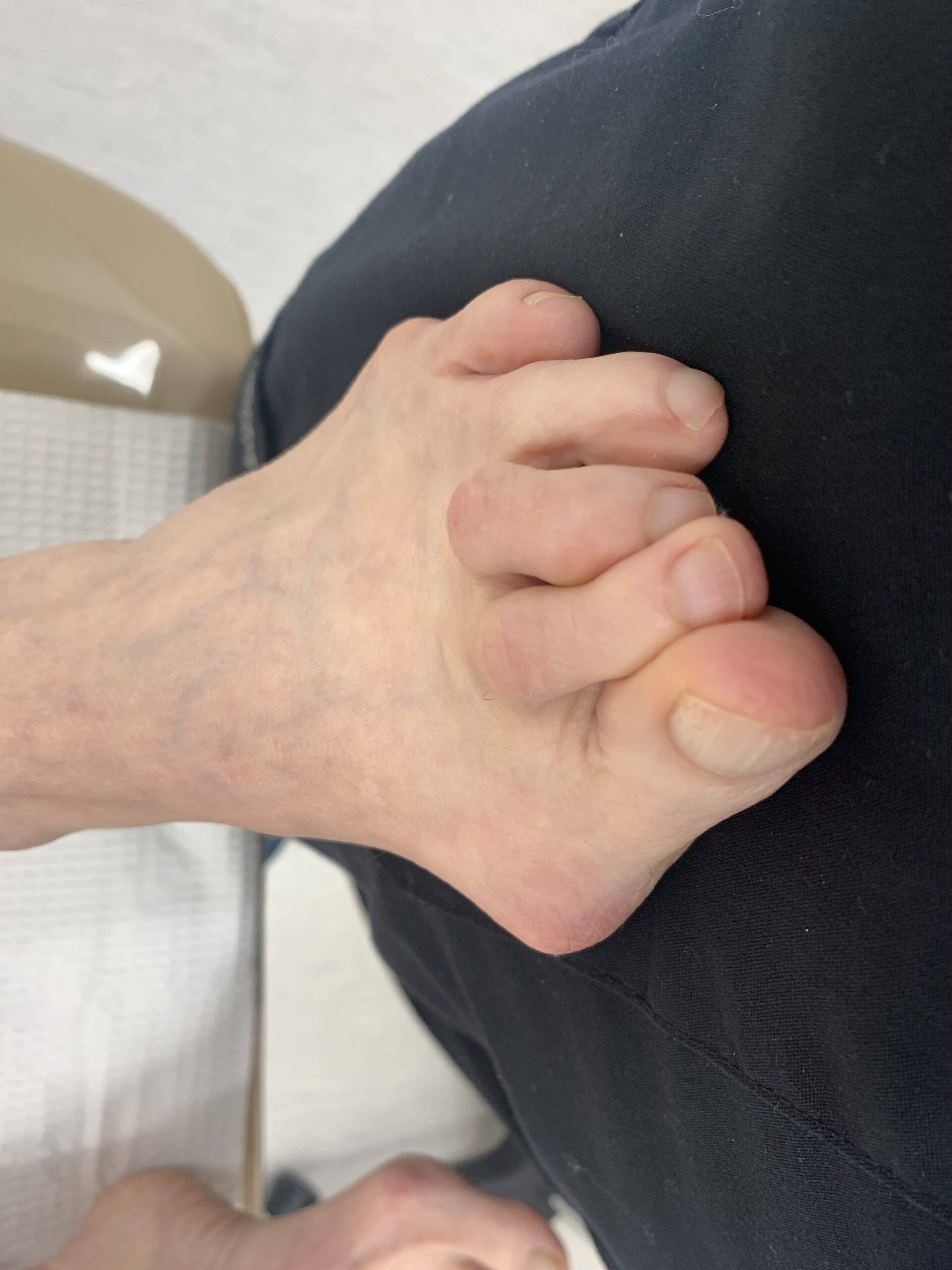 Before Surgery