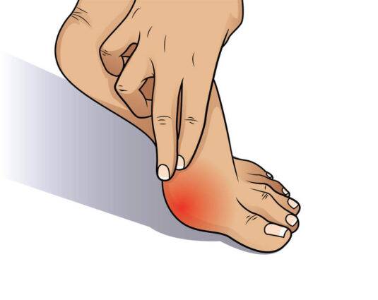 Bunion Pain