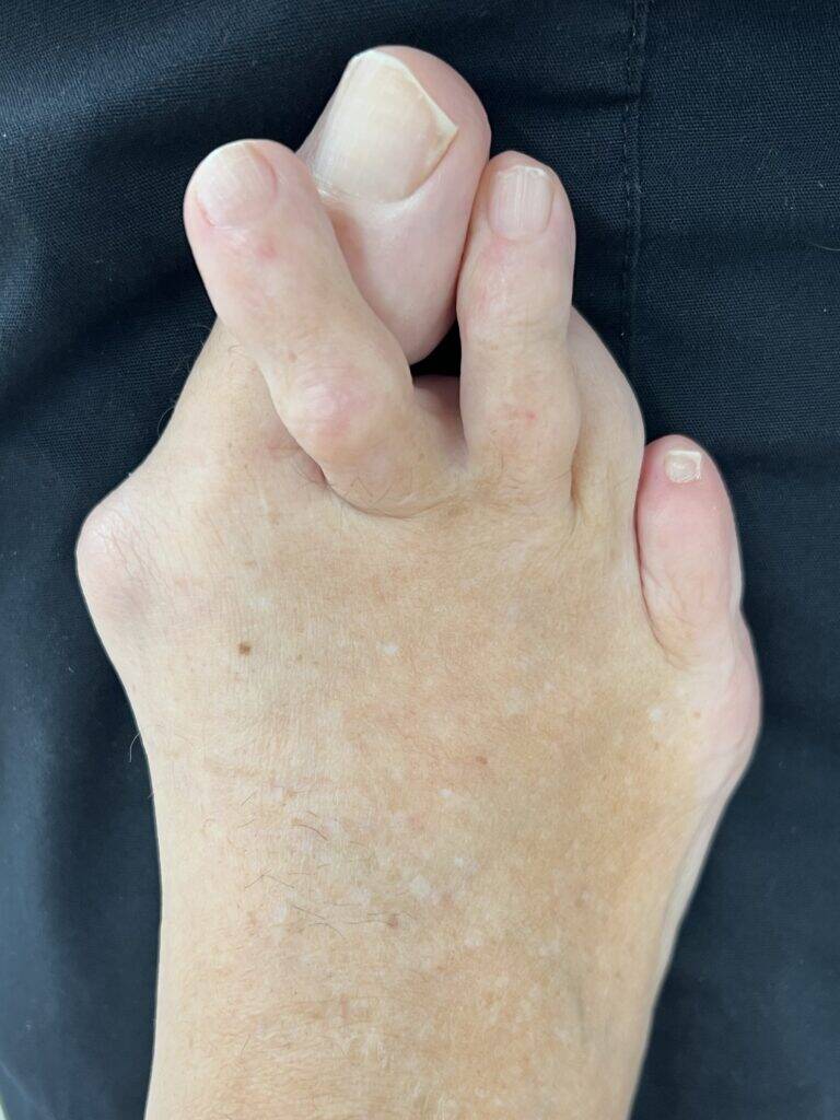 Before Surgery