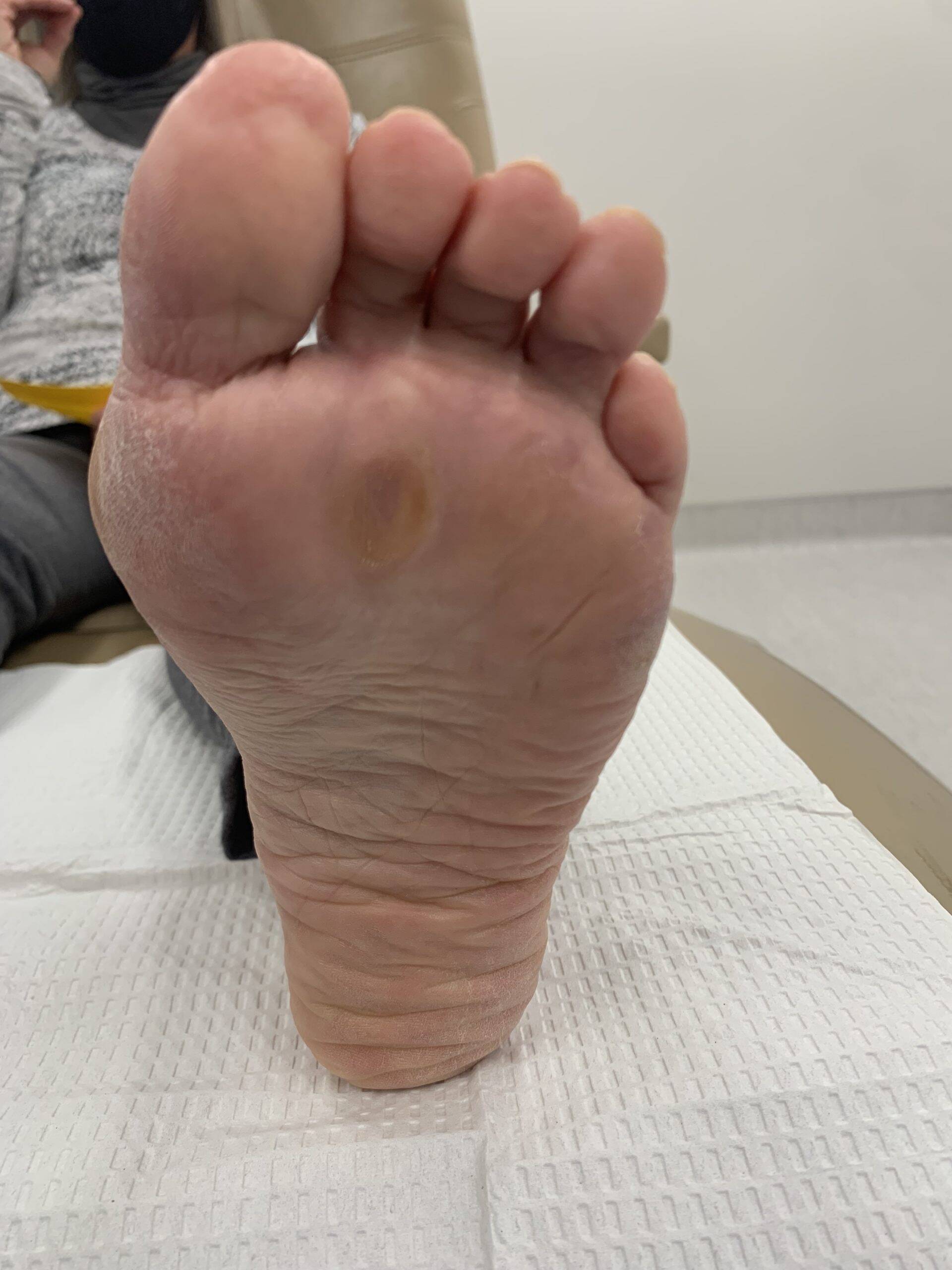 After Surgery