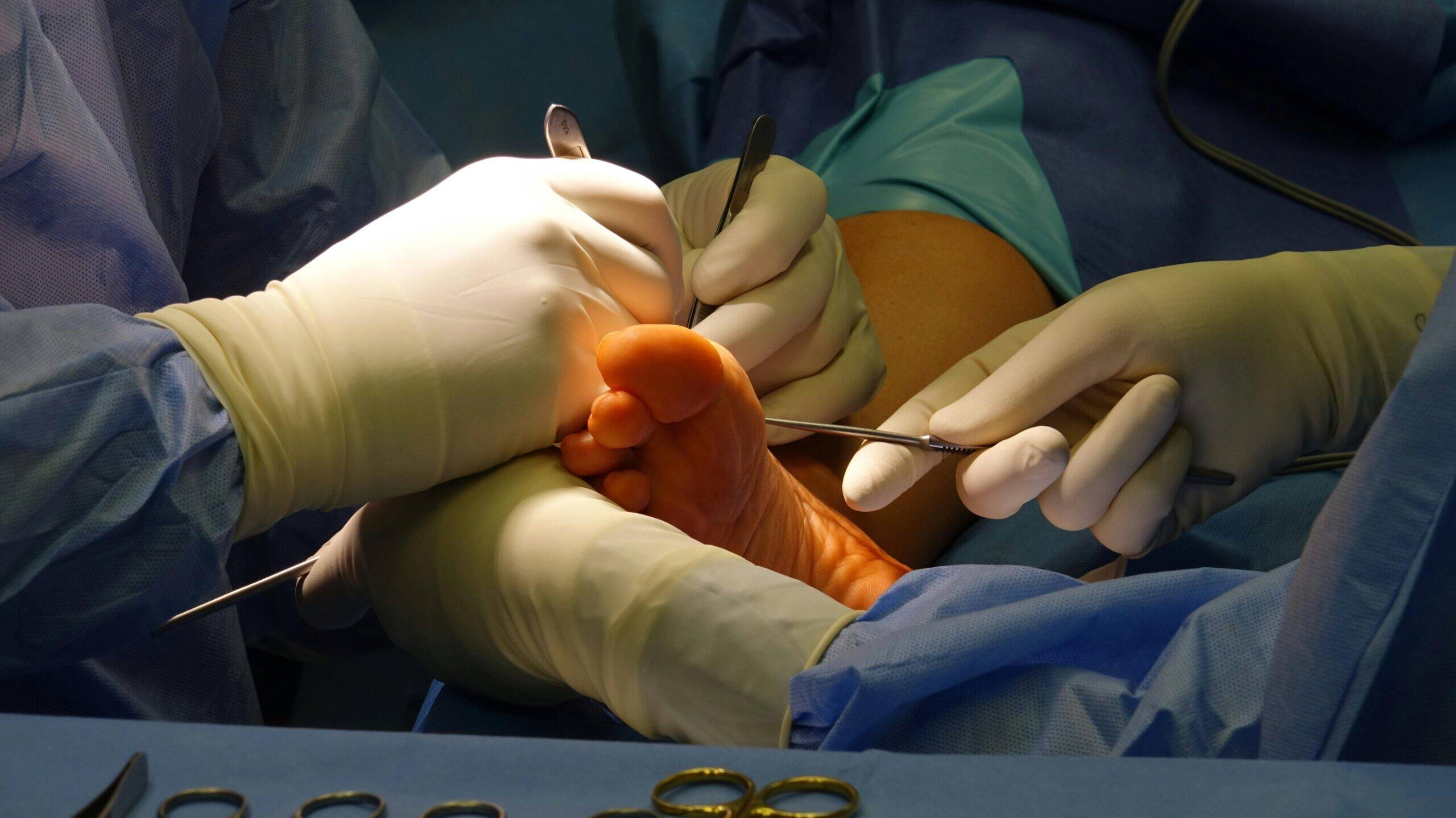 lapiplasty